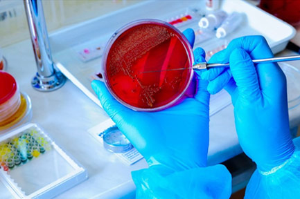 Clinical Microbiology - Theta Laboratory